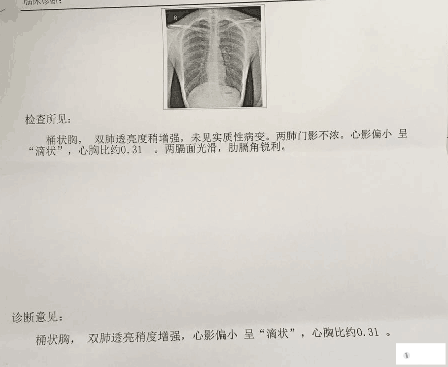 尘肺胸片报告模板图片