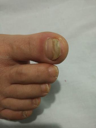 皮肤疾病猜图,积分大派送--297甲分离- 全科医