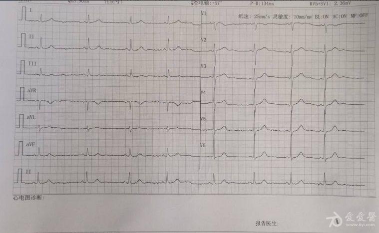 窦性心律能踢足球吗,窦性心律能踢足球吗?