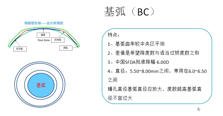 塑形镜的原理_△角膜塑形镜视力矫正原理