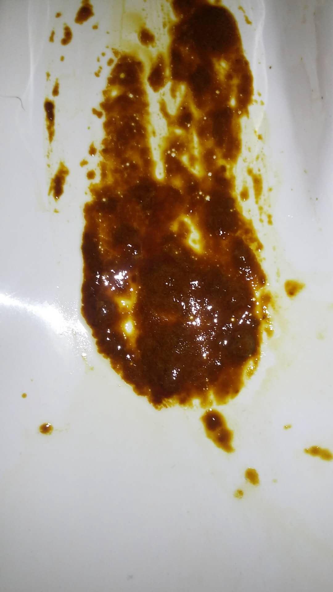 胃肠炎拉的屎图片图片