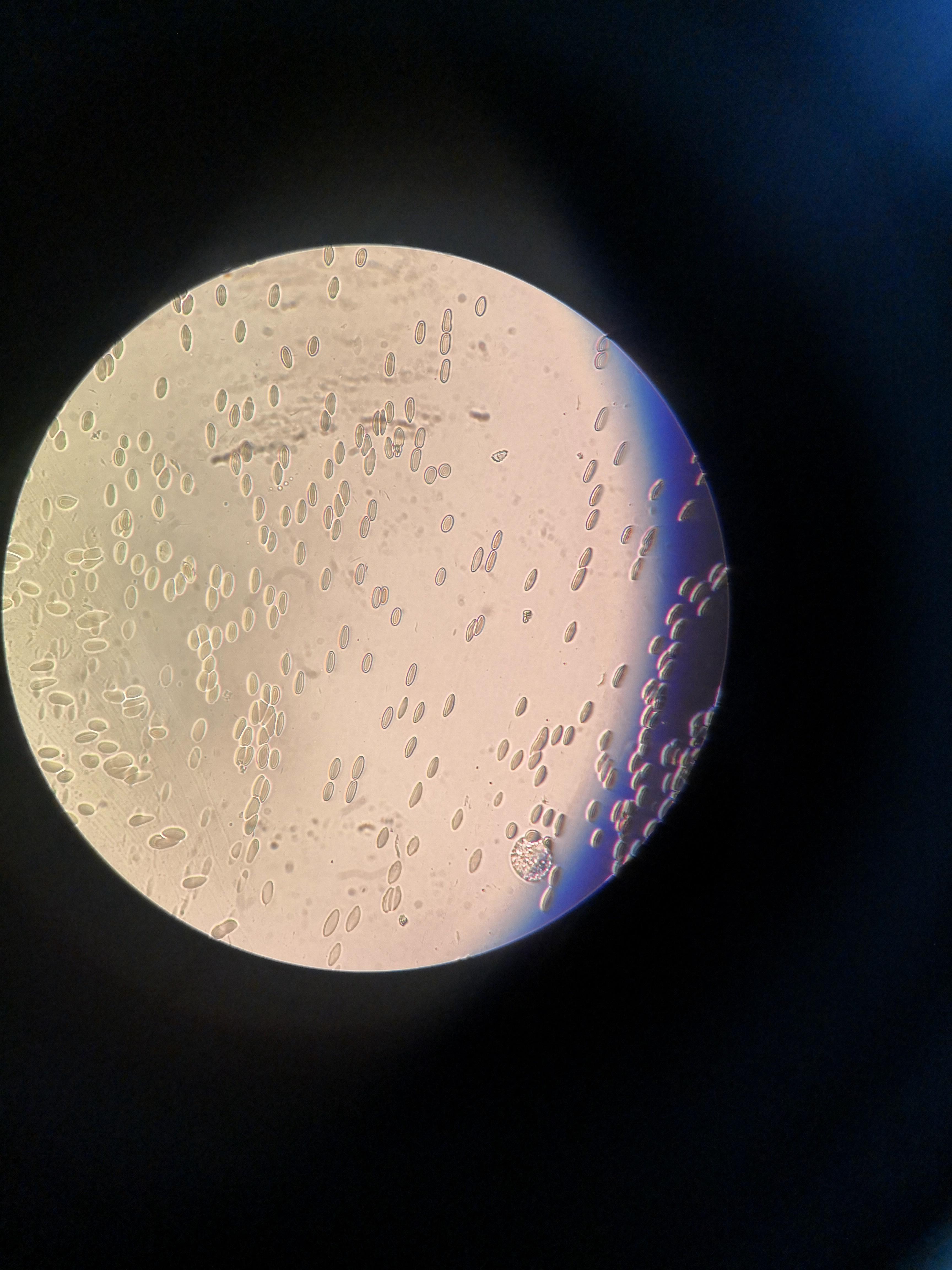 腱鞘囊肿液镜下细胞求教