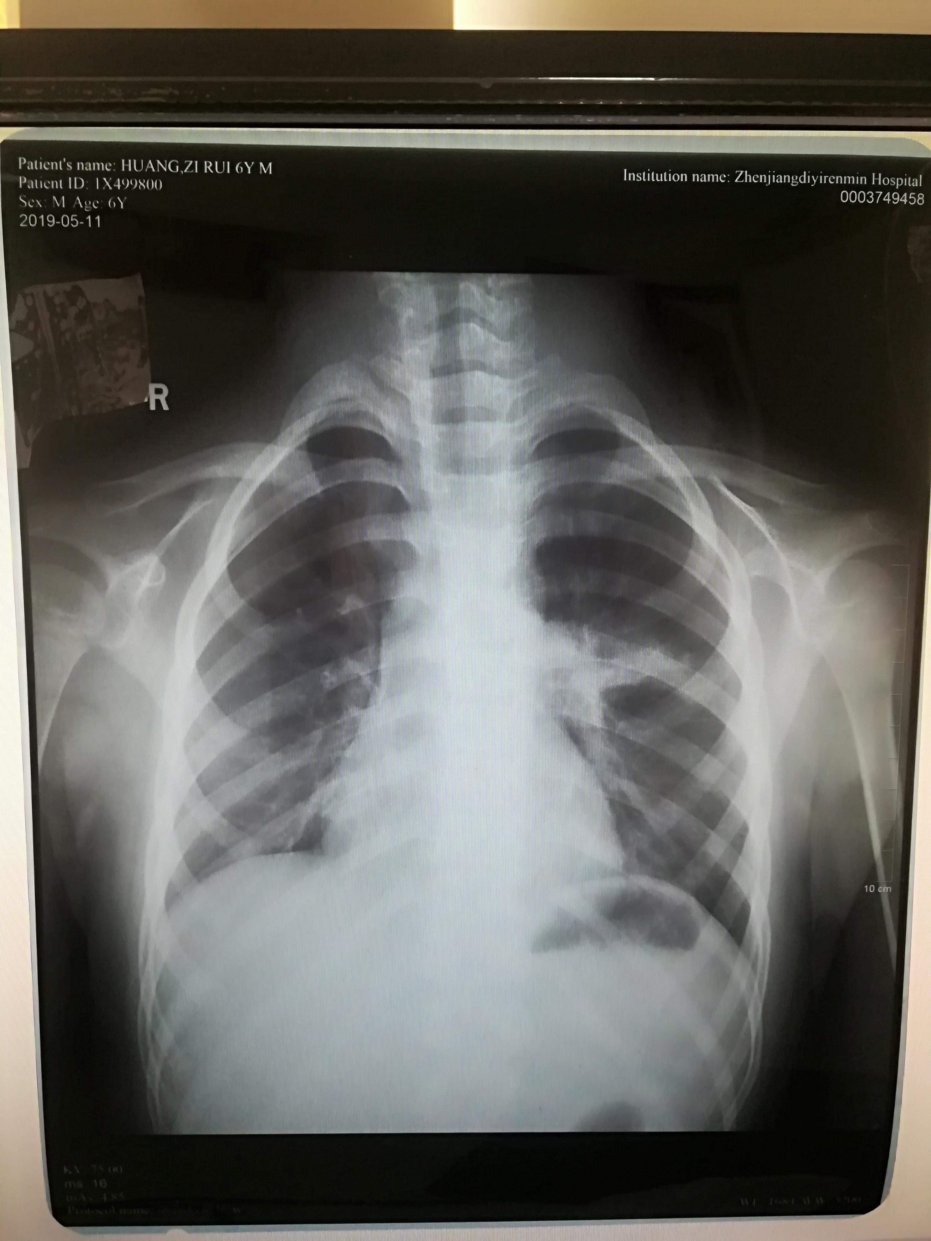 1905201624345ce26442d8d6a.jpg