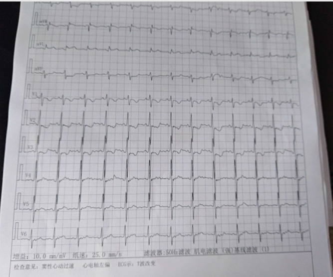 咳嗽的原理是什么意思_正常咳嗽痰是什么颜色(2)