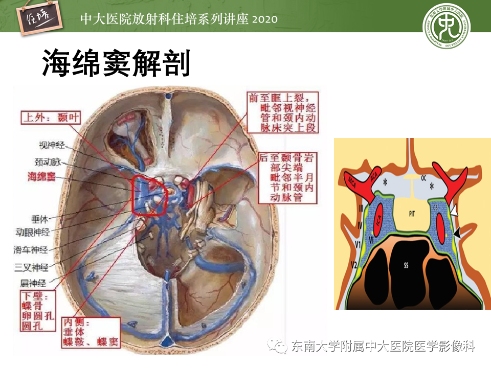 海绵窦的解剖结构图片