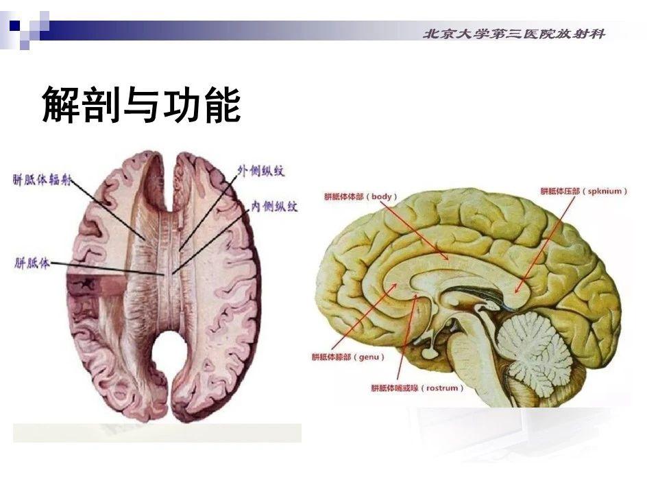 胼胝体压部图片图片