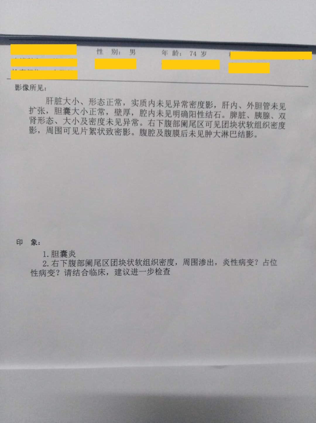 病例讨论:右下腹压痛,腹叩鼓音
