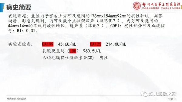 腹痛2月 竟是卵巢无性细胞瘤 妇产科专业讨论版 爱爱医医学论坛